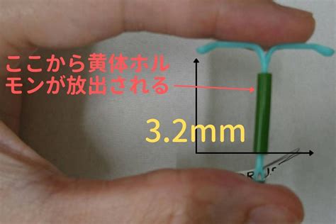 ミレーナ 中だし|子宮内避妊器具について 